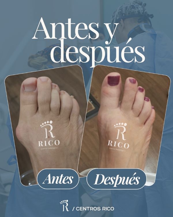Antes y después en Centros Rico